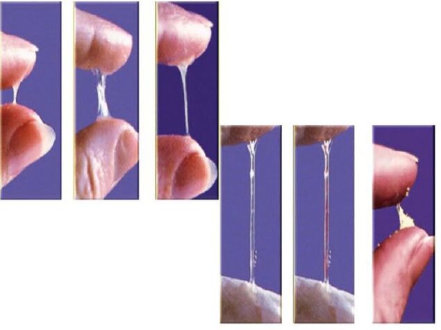 La cohérence de la préjaculation